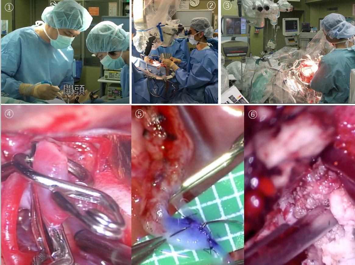開頭手術| 慶應義塾大学病院脳神経外科教室