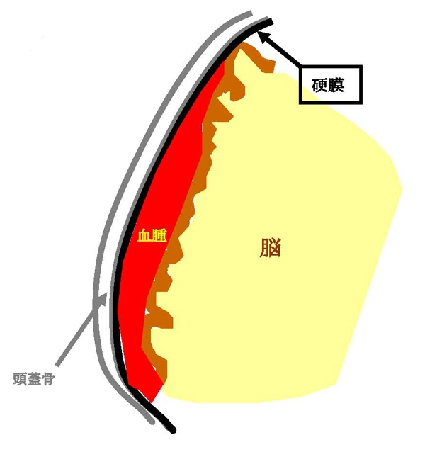 出血の特徴