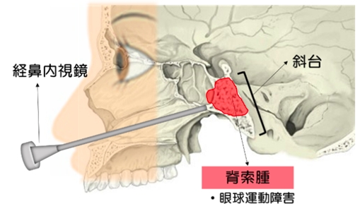 治療法