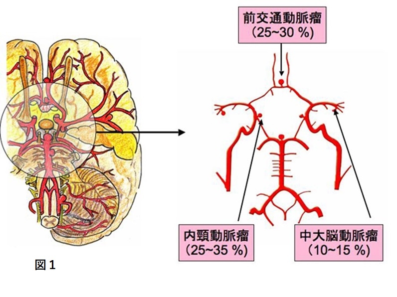 概要