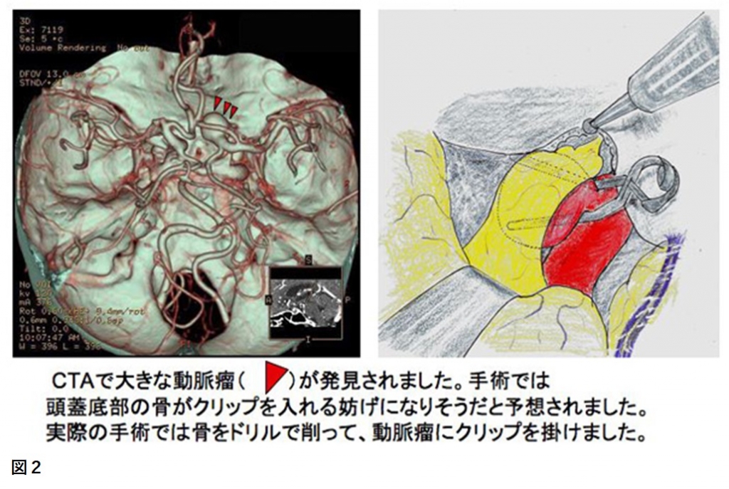 検査・診断