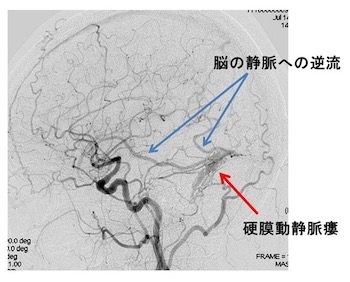 治療法（手術）