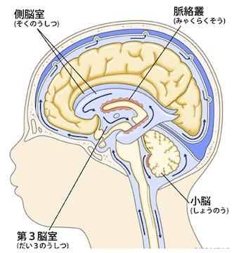 水頭症 慶應義塾大学病院脳神経外科教室