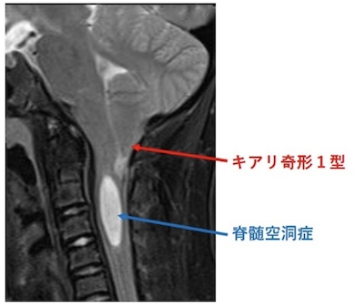 概要